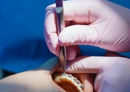 dental insurance breakdown form pdf